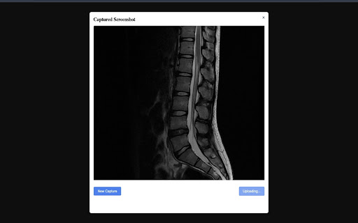 Bionic Spine from Chrome web store to be run with OffiDocs Chromium online Bionic Spine from Chrome web store to be run with OffiDocs Chromium online